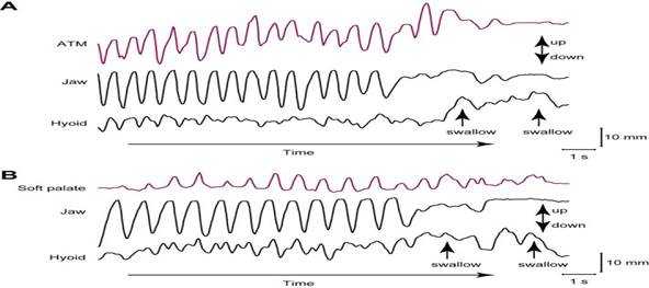 An external file that holds a picture, illustration, etc. Object name is nihms-79127-f0003.jpg