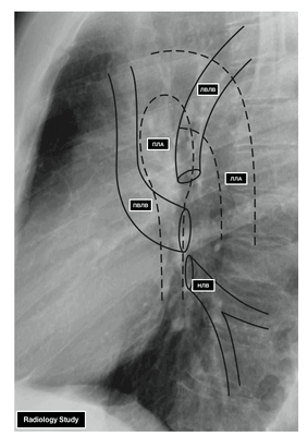 arterii-i-veny-legkogo