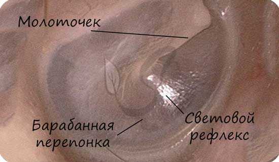 Фото барабанной перепонки