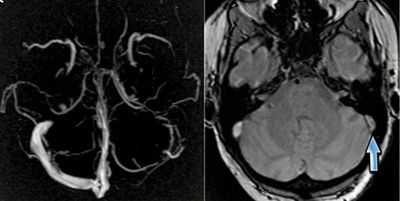 Диагностика патологий синусов
