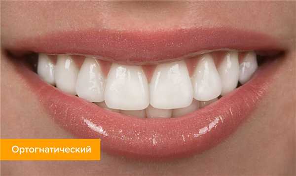 Фото ортогнатического прикуса