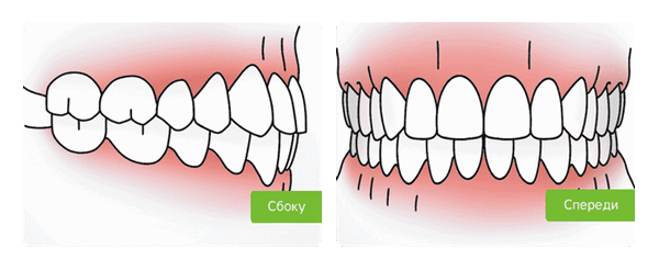 Правильный прикус у взрослого