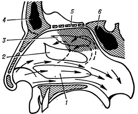 Рис. 1. Схематическое изображение обонятельной области и направления потоков вдыхаемого воздуха в носовой полости: 1 — нижняя носовая раковина; 2 — средняя носовая раковина; 3 — верхняя носовая раковина; 4 — sinus frontalis; 5 — lamina cribrosa; 6 — sinus splienoidalis; заштрихована сеткой собственно обонятельная рецепторная область на уровне верхней носовой раковины (стрелками показано направление движения потоков вдыхаемого воздуха).