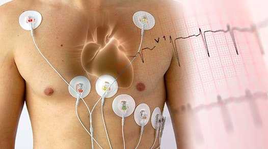 ЭКГ по Холтеру 