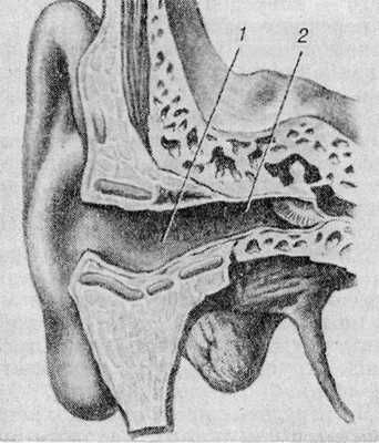 Рис. 2. Наружный слуховой проход (фронтальный разрез): 1 — хрящевая часть, 2 — костная часть.