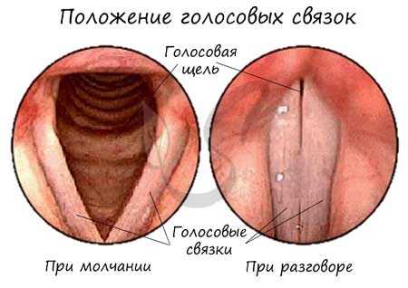 Положение голосовых связок