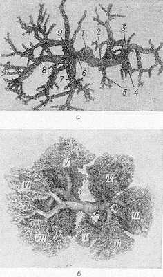 Рис. 3. Ветвление воротной вены (вид снизу)