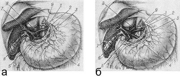 Рис. 2. Варианты формирования ствола воротной вены
