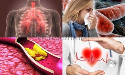 Причины появления патологии