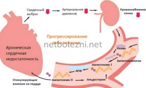 Хроническая сердечная недостаточность