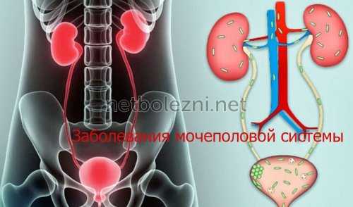 Заболевания мочеполовой системы