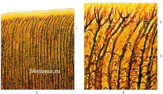 Где 1 - дентинные канальца, 2 - боковые ветвления дентинных канальцев, 3 - терминальные ветвления дентинных канальцев.