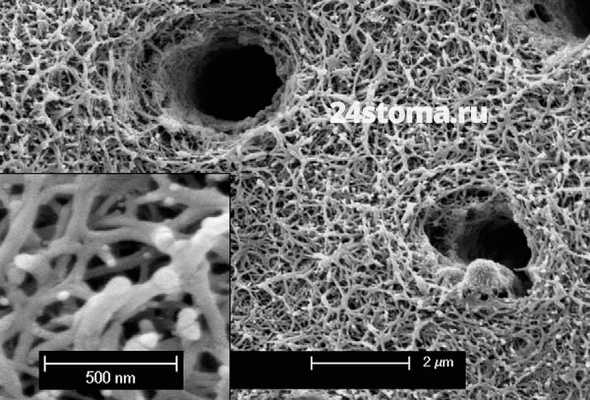 Электронная сканограмма деминерализованного участка околопульпарного дентина, где 1 - коллагеновые волокна органического матрикса, 2 - отверстия дентинных канальцев.