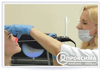 Эндоскопическая эндоназальная ревизия