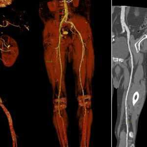 Снимок сосудов брюшной полости