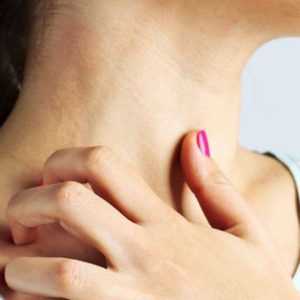 Аллергическая реакция