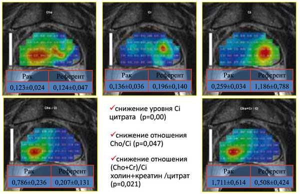 МРТ с динамическим контрастированием