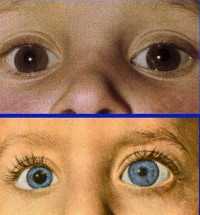 Назыров Альви Арбиевич, офтальмолог-хирург - Москва