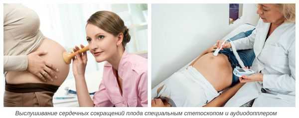 Выслушивание сердечных сокращений плода специальным стетоскопом и фетальным допплером