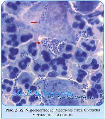 Гонококк (Neisseria gonorrhoeae)