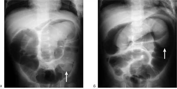 Чепрасов Владимир Дмитриевич, детский хирург - Сочи