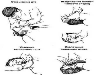правила первой помощи