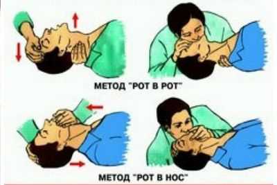 методика проведения искусственного дыхания