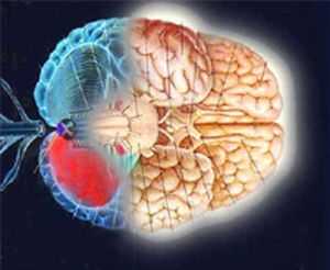 поражение мозга