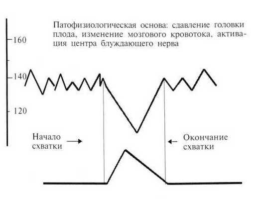 Кардиомонитор