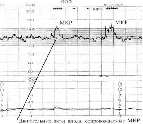 Вариабельность