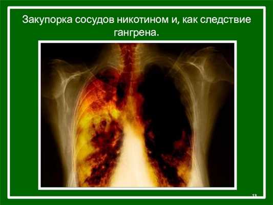 Закупорка сосудов никотином и, как следствие гангрена.