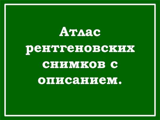 Атлас рентгеновских снимков с описанием.