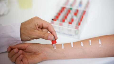 Аллергический контактный дерматит