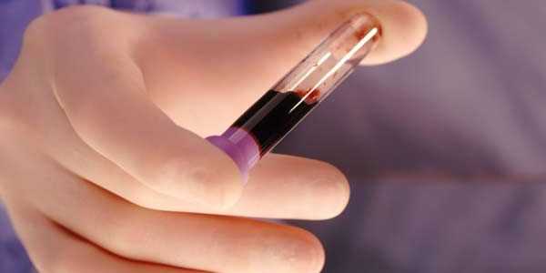 пересадка-костного-мозга-при-раке-крови