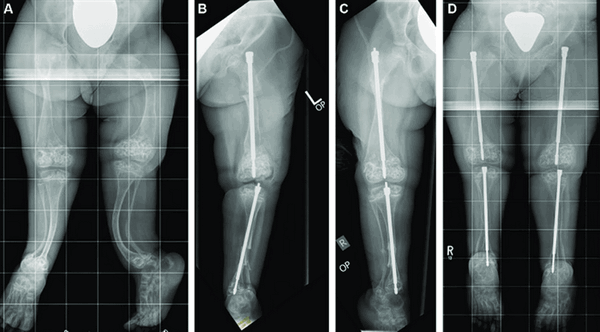 Оперативное лечение