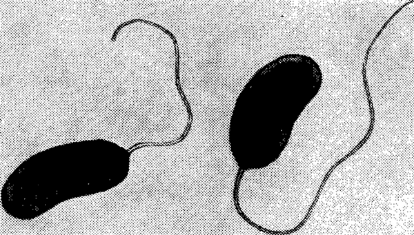 Vibrio cholerae (х 13 000).