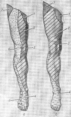 Зоны кожной иннервации нижней конечности (а и б — индивидуальные различия): 1 — ramus femoralis n. genitofemoralis; 2 — n. femoralis; 3 — n. obturatorius; 4 — nn. peroneus superficialis et profundus; 5 — n. peroneus communis и n. tibialis; 6—n. cutaneus femoris lat.; 7 — n. iliohypogastricus.