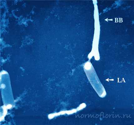 Лактобактерии и бифидобактерии