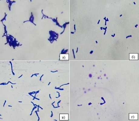 Рис.2. Микрофотографии окрашенных метиленовым синим фиксированных препаратов некоторых выделенных бифидобактерий (х100 иммерсия).