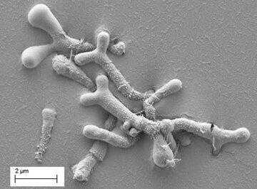 Bifidobacteria pseudocatenulatum