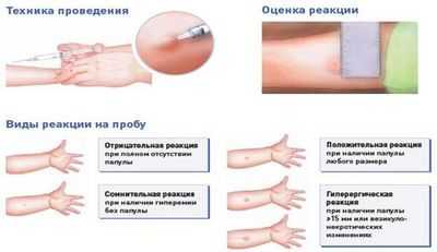 оценка результатов теста