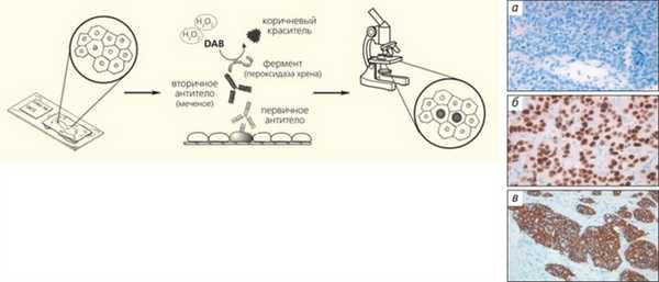 Рис. 3. Схема иммуногистохимического (ИГХ) метода и примеры его применения («Природа» №6, 2018) 