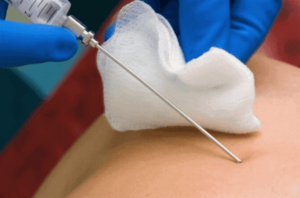 Игла для биопсии