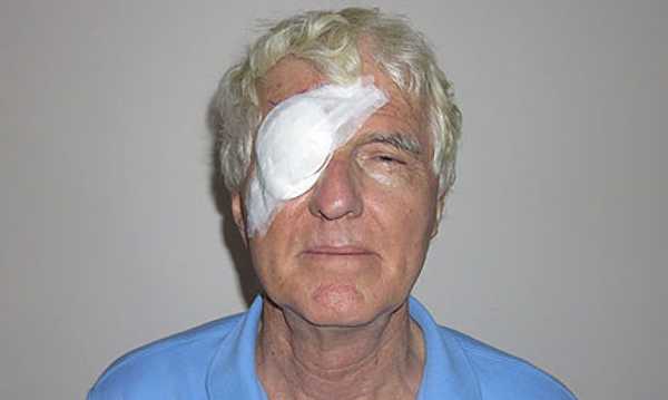 Цены на операцию по удалению халязиона