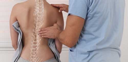 Межреберная невралгия