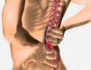 миелопатия