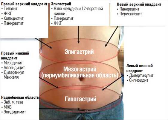  Рисунок 9. Проекция париетальной боли