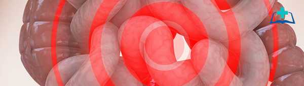 Механизмы возникновения абдоминальной боли