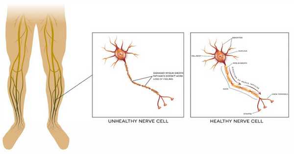 механизмы боли