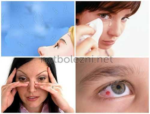 Проблемы нарушения зрения